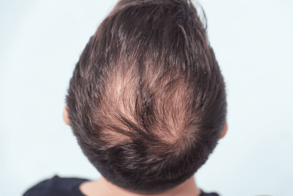 best anti aging treatment for hair