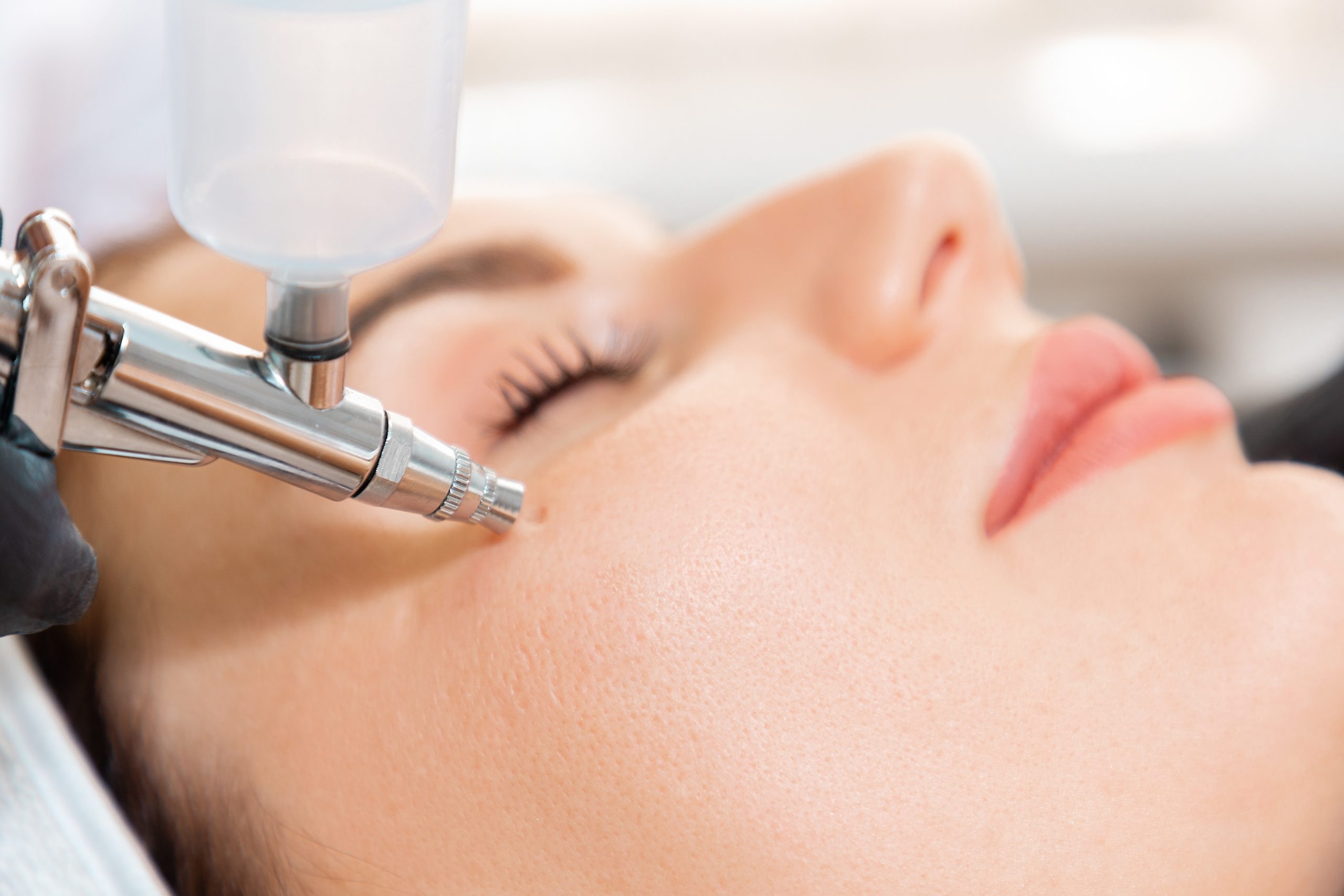 Face Beauty Treatment. Close up of client's face getting gas-liquid oxygen water epidermal peeling using hardware apparatus. Concept of cosmetology.